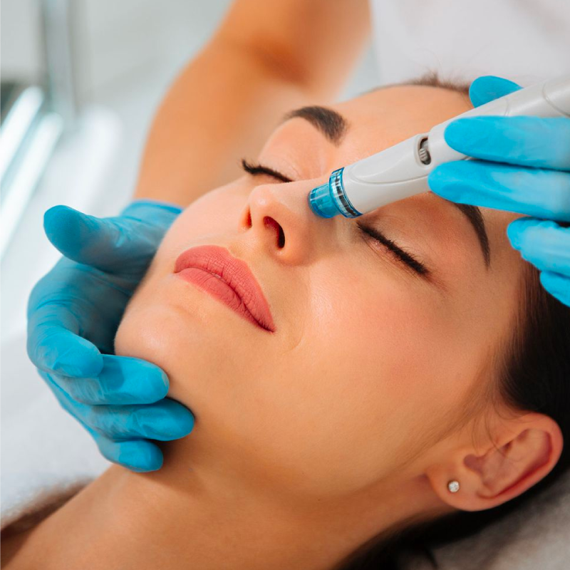 hydrafacial_balbasantiaging